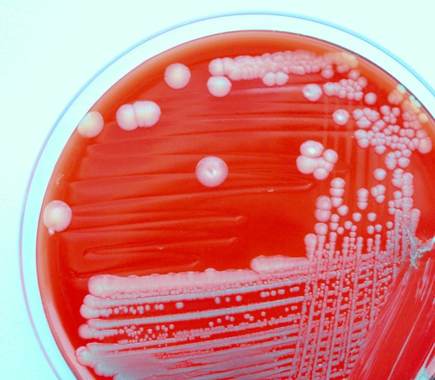 Voorkomen is beter dan genezen: hoe de Nederlandse Arbeidsinspectie (NLA) toeziet op biosafety